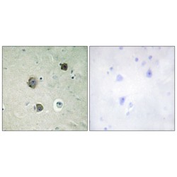 Cyclin-Dependent-Like Kinase 5 (CDK5) Antibody