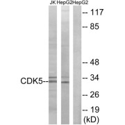 Western blot analysis of extracts from Jurkat cells and HepG2 cells, using CDK5 (epitope around residue 15) antibody.