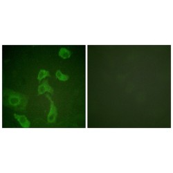 p47 phox Antibody