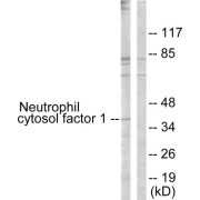 Western blot analysis of extracts from COS7 cells, treated with UV (15mins), using Neutrophil Cytosol Factor 1 (epitope around residue 304) antibody.