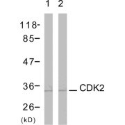 Western blot analysis using CDK2 (epitope around residue 161) Antibody (abx012847) Line1: The extracts from A2780 cells; Line2: The extracts from MDA-MB-435 cells.