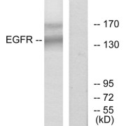 Western blot analysis of extracts from HT-29 cells, using EGFR (epitope around residue 1172) antibody.