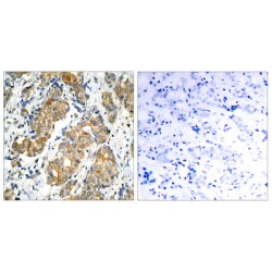 GSK3 alpha Antibody