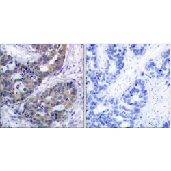 Insulin Receptor Substrate 1 (IRS-1) Antibody