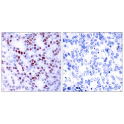 Transcription Factor Jun (JUN) Antibody