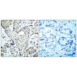 Dual Specificity Mitogen-Activated Protein Kinase Kinase 3 (MKK3) Antibody