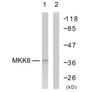 Western blot analysis using MKK6 (epitope around residue 207) Antibody (abx012869). Line1: The extracts from MDA-MB-435 cells; Line2: The extracts from MDA-MB-435 cells using abx012869 preincubated with synthesized peptide.