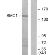 Western blot analysis of extracts from 293 cells, treated with UV (15mins), using SMC1 (epitope around residue 957) antibody.