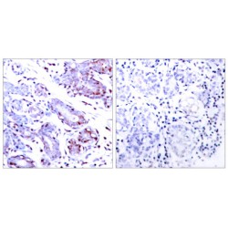 Signal Transducer And Activator of Transcription 1 (STAT1) Antibody