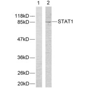 Western blot analysis of extracts from COLO205 cells using STAT1 (epitope around residue 701) antibody (abx012882). The lane on the left is treated with peptide.