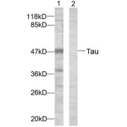 Western blot analysis of extracts from HeLa cells. Line1: Using Tau (epitope around residue 396) Antibody (abx012887) ; Line2: the same antibody preincubated with synthesized peptide.