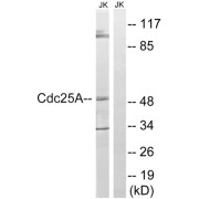 Western blot analysis of extracts from Jurkat cells, using CDC25A (epitope around residue 178) antibody.