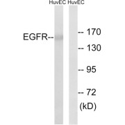 Western blot analysis of extracts from HUVEC cells, using EGFR (epitope around residue 1026) antibody.