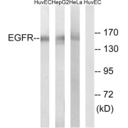 Western blot analysis of extracts from HUVEC cells, HepG2 cells and HeLa cells, using EGFR (epitope around residue 1071) antibody.