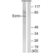 Western blot analysis of extracts from K562 cells, using Ezrin (epitope around residue 478) antibody.