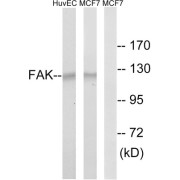 Western blot analysis of extracts from HUVEC cells and MCF-7 cells, using FAK (epitope around residue 843) antibody.