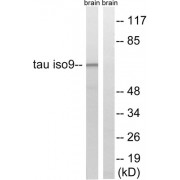 Western blot analysis of extracts from rat brain cells, using Tau (epitope around residue 534/217) antibody.