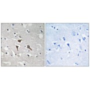 Immunohistochemistry analysis of paraffin-embedded human brain tissue using ALK antibody.