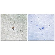 Immunohistochemistry analysis of paraffin-embedded human brain tissue using IRAK1 antibody.