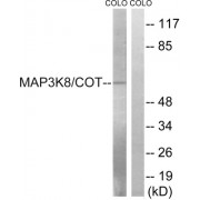Western blot analysis of extracts from COLO cells, treated with Insulin (0.01U/ml, 15mins), using MAP3K8 (epitope around residue 400) antibody.