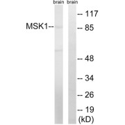 Western blot analysis of extracts from mouse brain cells, using MSK1 (epitope around residue 212) antibody.