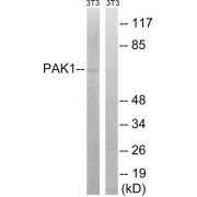 Western blot analysis of extracts from 3T3 cells, treated with UV (15mins), using PAK1 (epitope around residue 204) antibody.