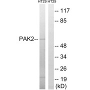 Western blot analysis of extracts from HT-29 cells, using PAK2 (epitope around residue 197) antibody.