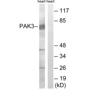 Western blot analysis of extracts from rat heart, using PAK3 (epitope around residue 154) antibody.