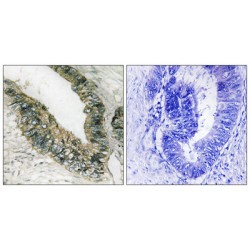 Eukaryotic Translation Initiation Factor 2 Alpha Kinase 3 (EIF2AK3) Antibody