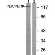 Western blot analysis of extracts from MCF-7 cells, using PEK/PERKantibody. The lane on the right is blocked with the synthesized peptide.