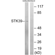 Western blot analysis of extracts from COLO cells, using STK39 (epitope around residue 325) antibody.