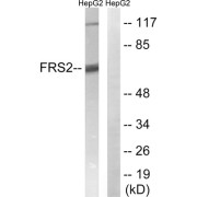 Western blot analysis of extracts from HepG2 cells, using FRS2 (epitope around residue 196) antibody.