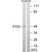 Western blot analysis of extracts from RAW264.7 cells, using FOS (epitope around residue 232) antibody.