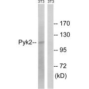 Western blot analysis of extracts from 3T3 cells, using PYK2 (epitope around residue 579) antibody.