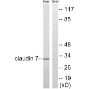 Western blot analysis of extracts from rat liver cells, using Claudin 7 (epitope around residue 210) antibody.