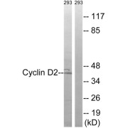 Western blot analysis of extracts from 293 cells, using Cyclin D2 (epitope around residue 280) antibody.