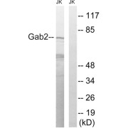 Western blot analysis of extracts from Jurkat cells, treated with TNF (2500U/ml, 30mins), using Gab2 (epitope around residue 623) antibody.