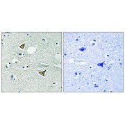 Immunohistochemistry analysis of paraffin-embedded human brain tissue using Girdin antibody.