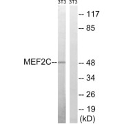 Western blot analysis of extracts from 3T3 cells, treated with starved (24hours), using MEF2C (epitope around residue 396) antibody.