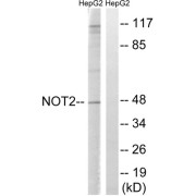 Western blot analysis of extracts from HepG2 cells, treated with starved (24hours), using CNOT2 (epitope around residue 101) antibody.