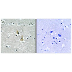 p47 phox Antibody