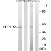 Western blot analysis of extracts from COLO cells, HepG2 cells and HUVEC cells, using PPP1R2 (epitope around residue 44) antibody.