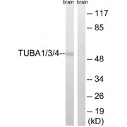 Western blot analysis of extracts from Rat brain cells, using TUBA1/3/4 (epitope around residue 272) antibody.