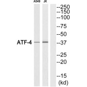 Cyclic AMP-Dependent Transcription Factor ATF-4 (ATF4) Antibody