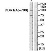 Epithelial Discoidin Domain-Containing Receptor 1 (DDR1) Antibody