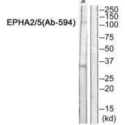 EPHA2 / 5 Antibody