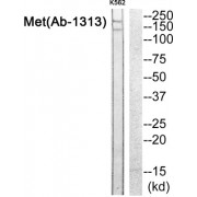 Western blot analysis of extracts from K562 cells, using Met (epitope around residue 1313) antibody.