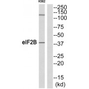 eIF2B Antibody
