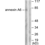 Western blot analysis of extracts from 293 cells, using Annexin A6 antibody.