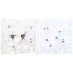 Bcl2 Associated X Protein (BAX) Antibody